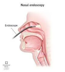 Endoscopy Of Nose And Larynx image 1