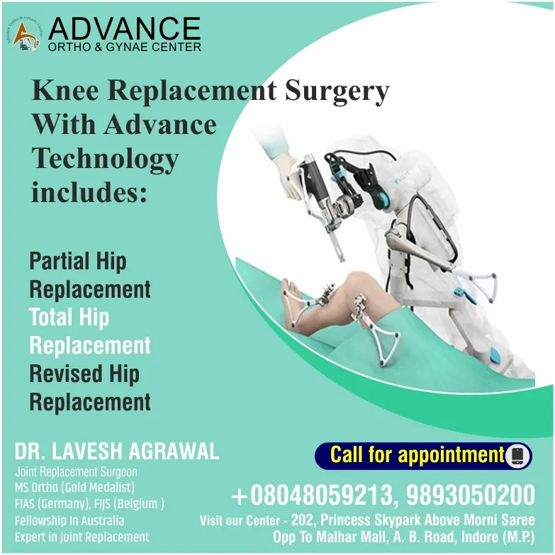 Knee replacement Treatment image 1