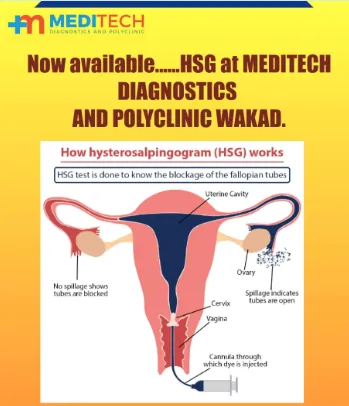 HYSTEROSALPINGOGRAPHY (HSG) CENTRE IN WAKAD,HINJEWADI,PCMC image 1