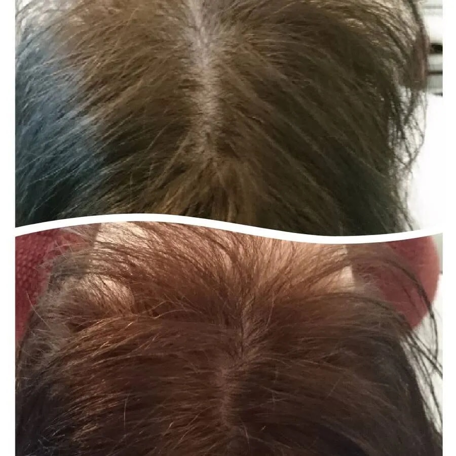Hair Rejuvenation Treatment image 1
