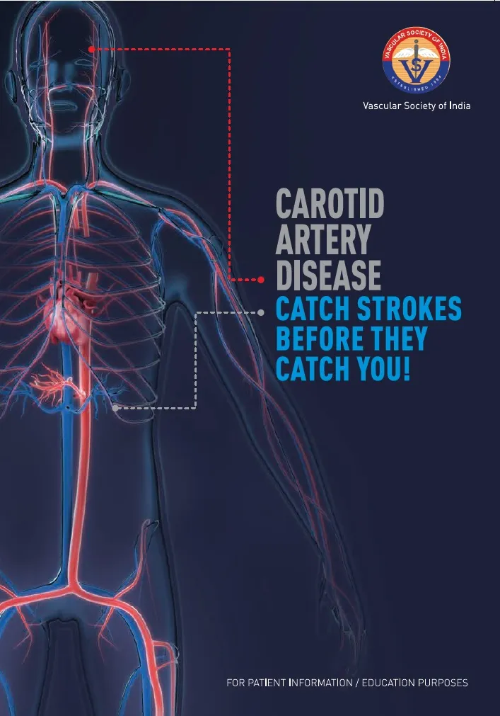 CAROTID ARTERY DISEASE image 2