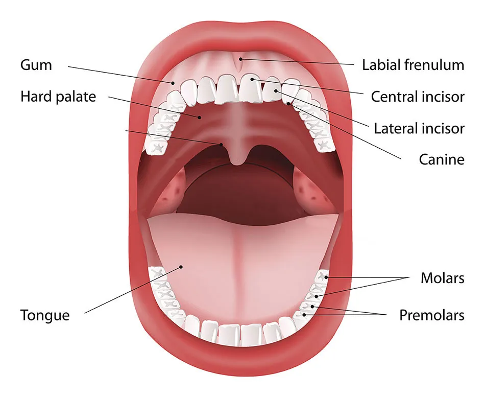 Oral Cancer image 1