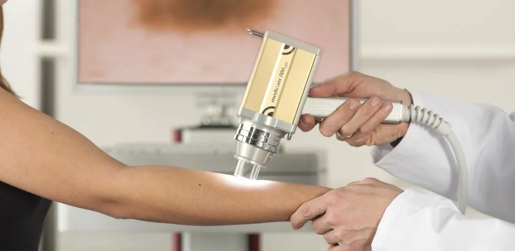 CANCER SCREENING image 1