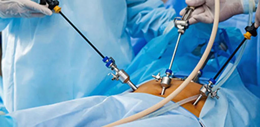 HYSTERECTOMY AND OTHER GYNECOLOGICAL SURGERIES image 1