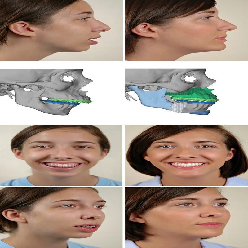 Esthetic Jaw Surgery image 1