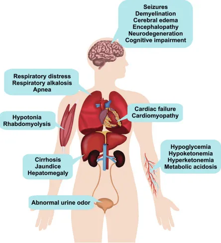 Inborn Errors of Metabolism image 1