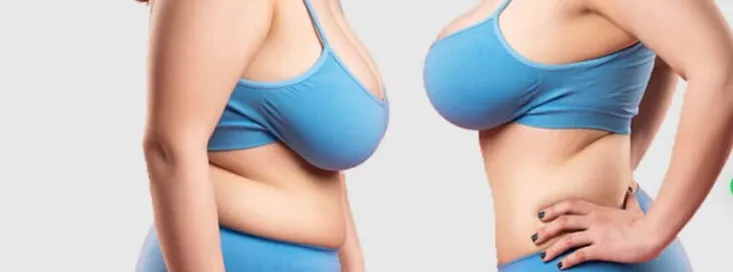 Breast Reduction & Lift image 2