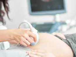 Sonography image 1