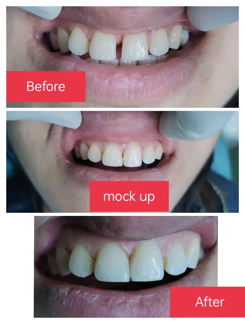 dental image 1