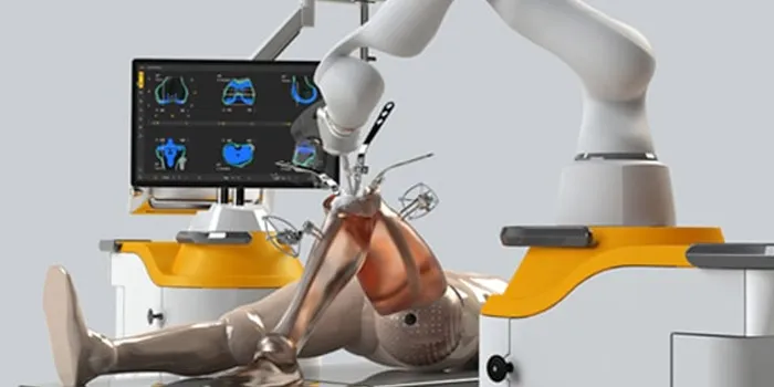 Robotic Joint Replacement image 1