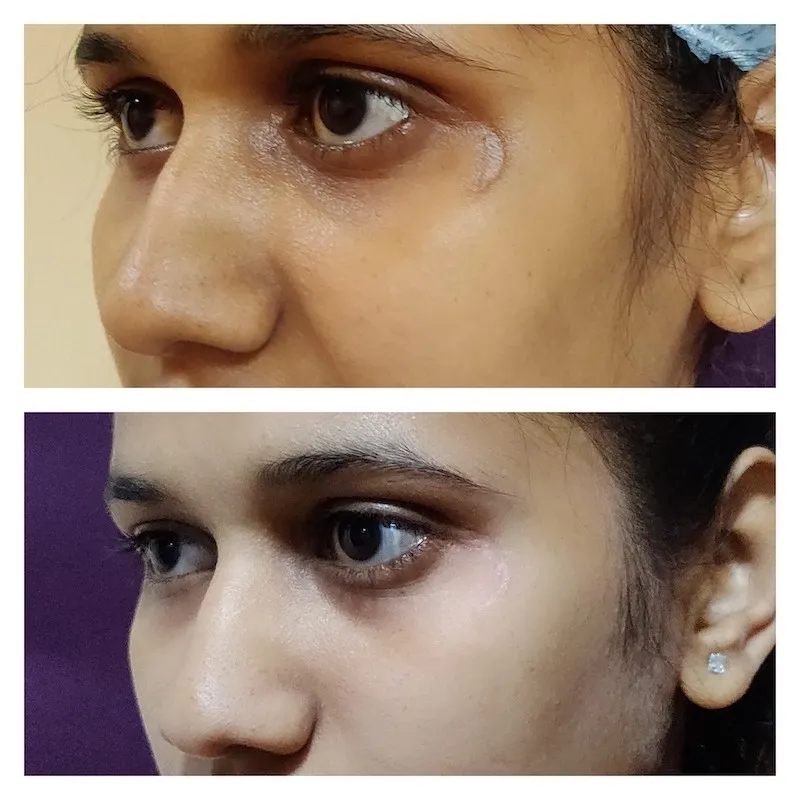 SCAR REVISION image 1