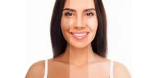 BODY WHITENING image 1