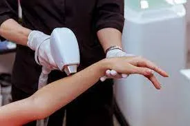 UNWANTED HAIR REMOVAL FULL HANDS  image 1