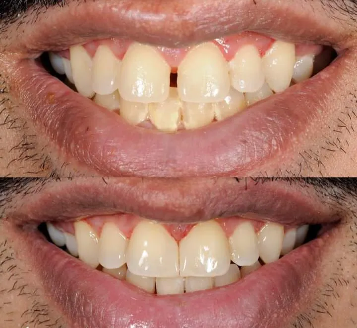 Smile Designing   image 1