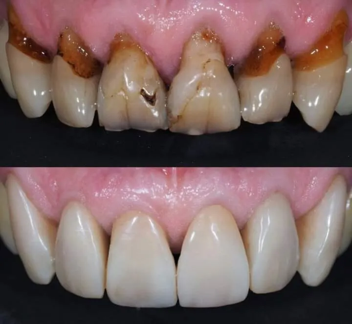 Aesthetic Smile Designing  image 1
