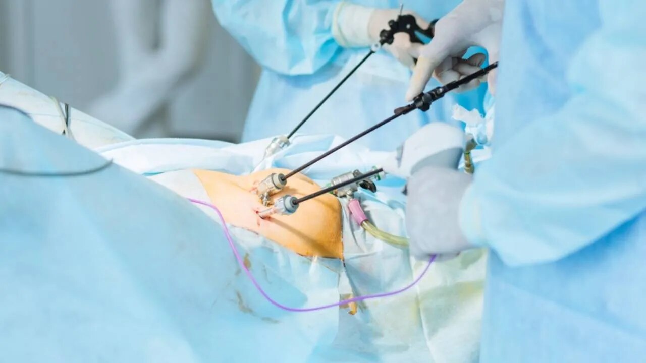 LAPAROSCOPY
image 1