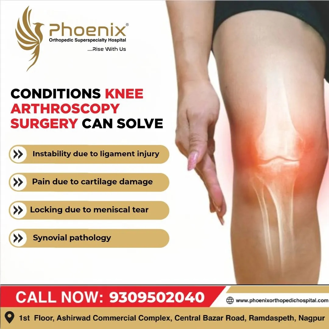 Treatment of Joint pain and Arthritis image 1
