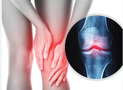 Joint Replacement image 1
