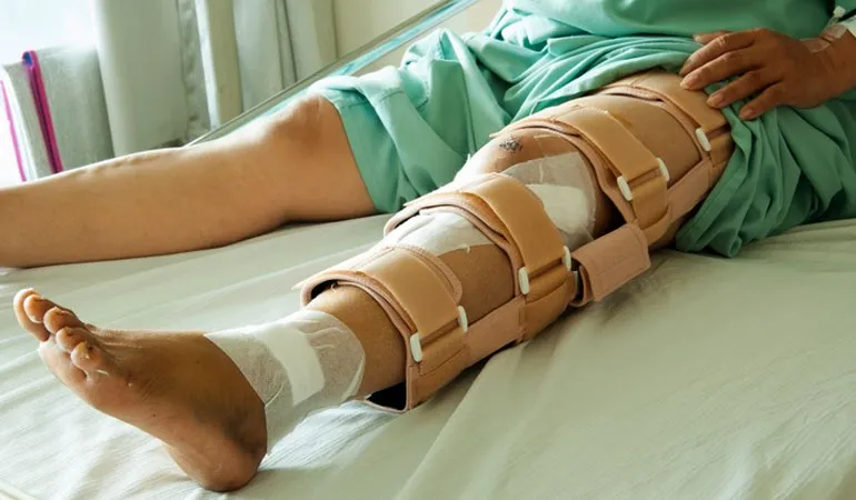 Fracture Surgery image 1