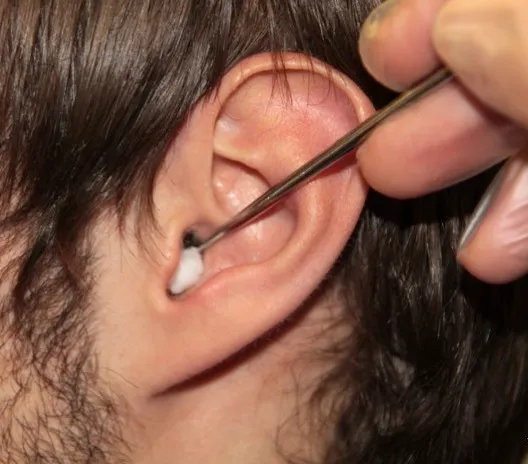 Foreign body removal From Ear, Nose and Throat image 1