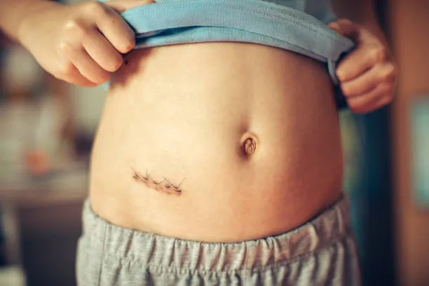 Appendix image 1