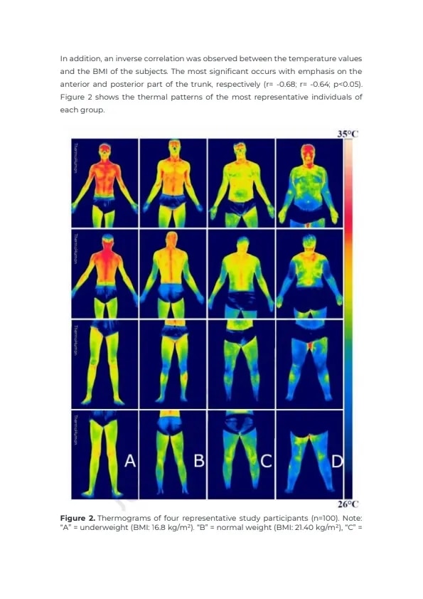Thermography  image 1