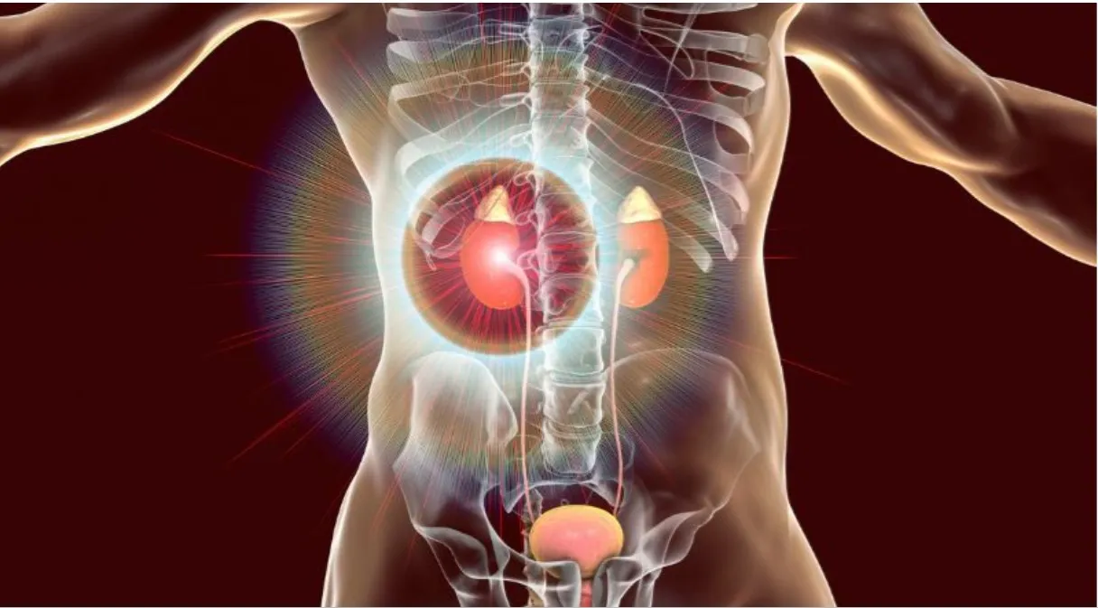 Kidney Stone Laser Surgeries image 1
