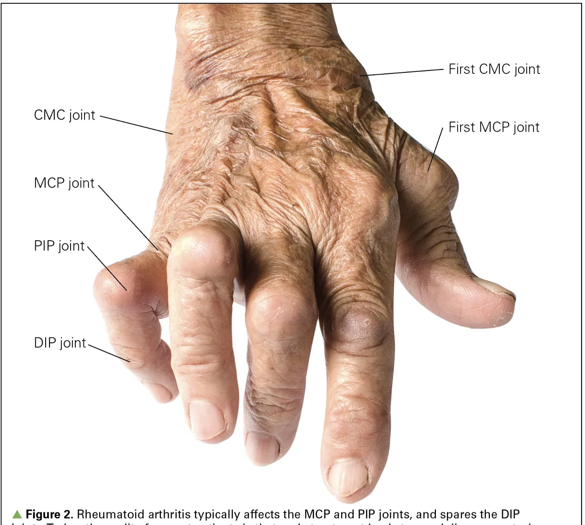 Rheumatology (संधिवातशास्त्र) image 1
