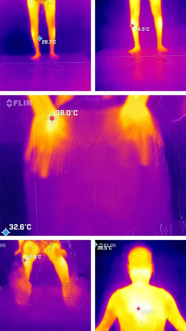 Thermography  image 1