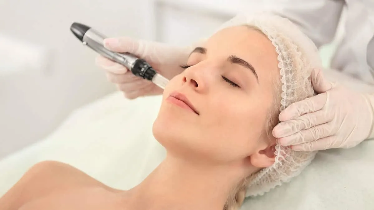 DERMA PEN image 1
