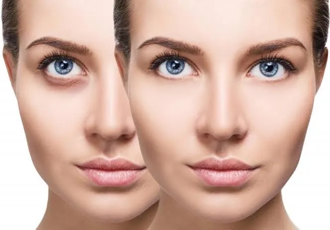 EYE PEEL image 1
