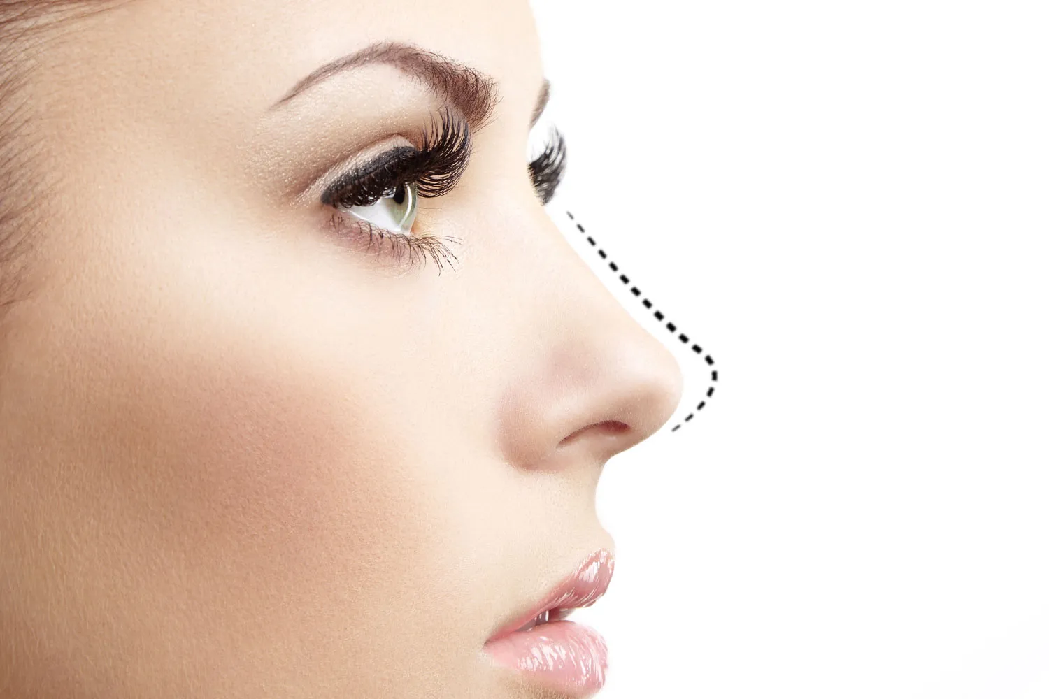 NOSE RESHAPING image 1