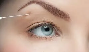 EYEBROW LIFT image 1