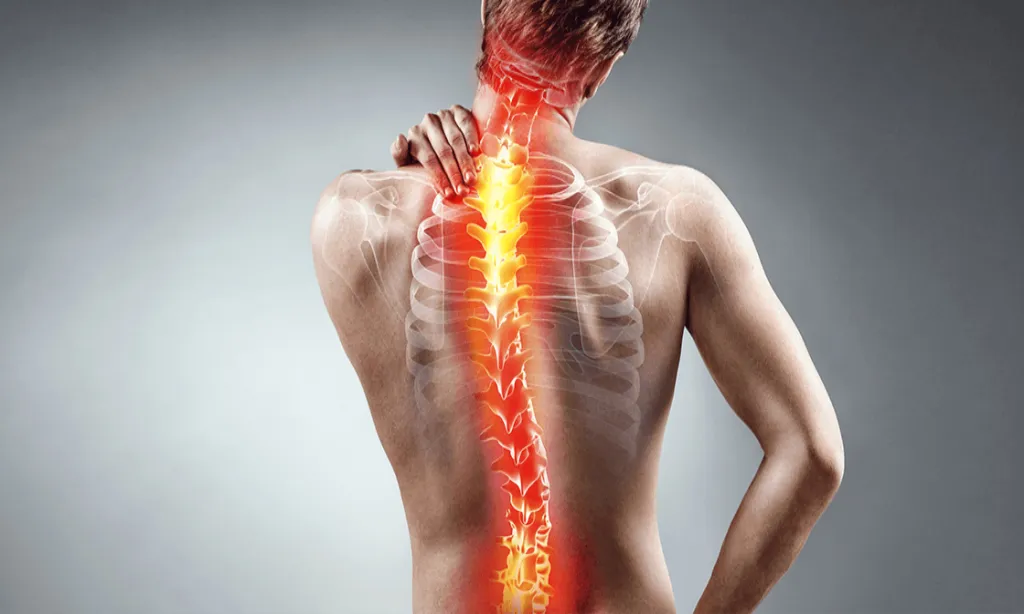 Scoliosis Correction Treatment in Pune image 1