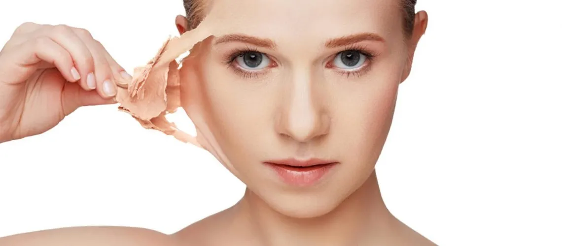 CHEMICAL PEEL image 1