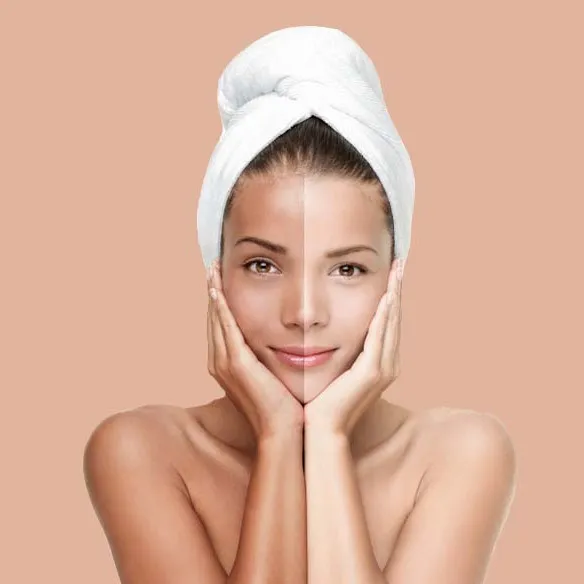 Skin Lightening Treatment in Thane image 1