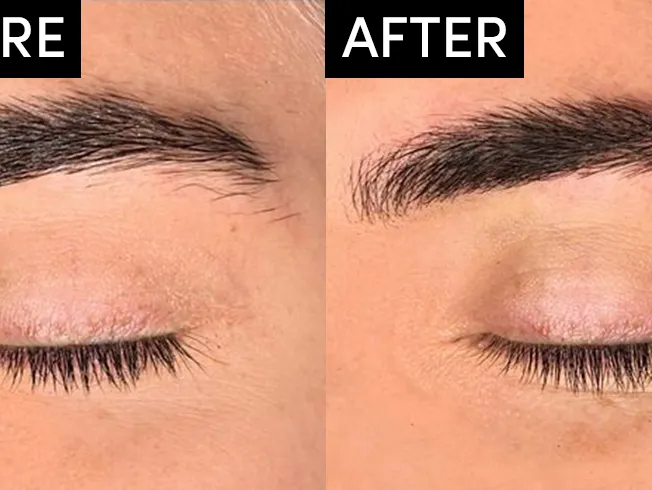 Microblading of Eyebrows image 1