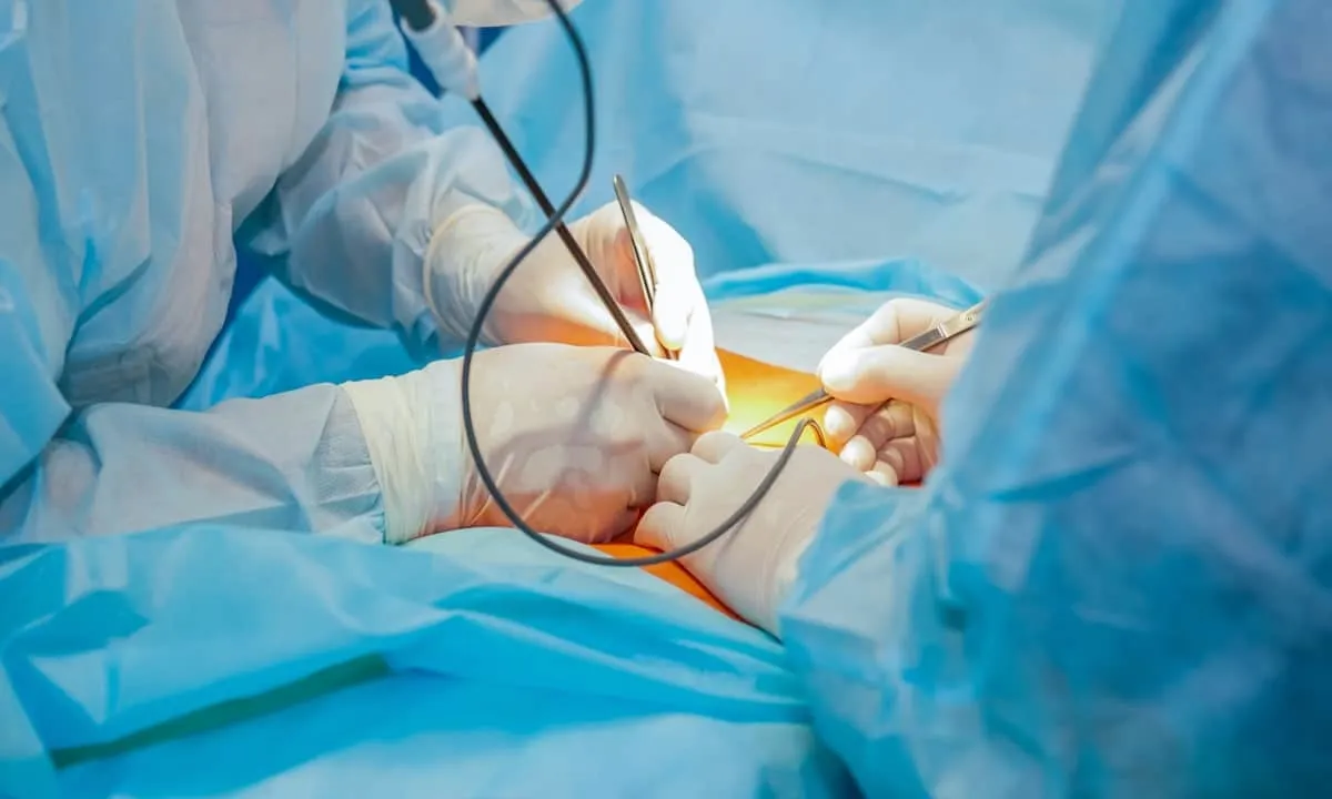 Gastro and Colorectal Surgery Laproscopic image 1