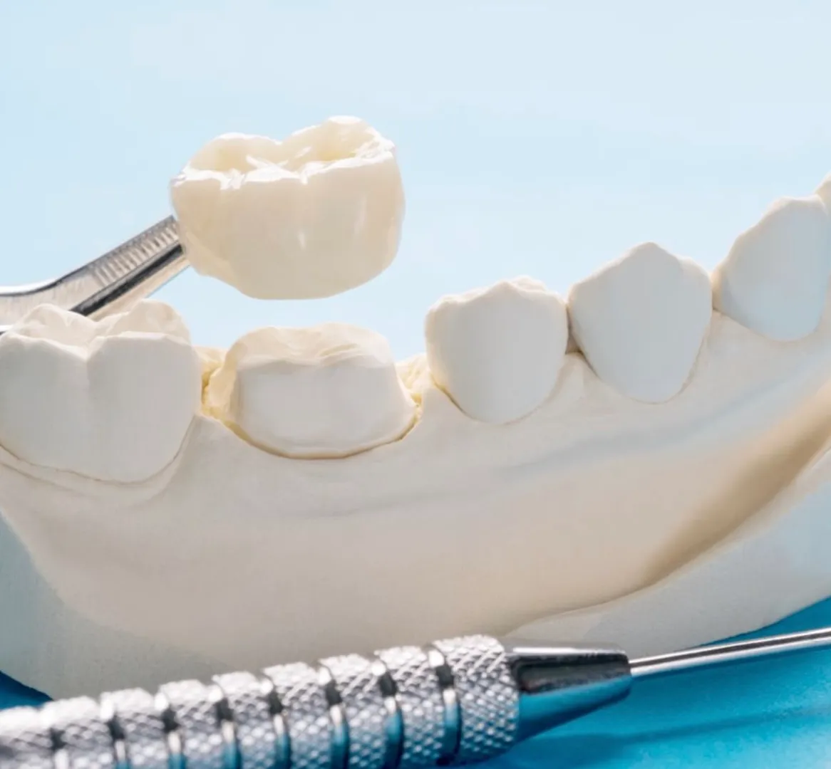 Dental Crown image 1