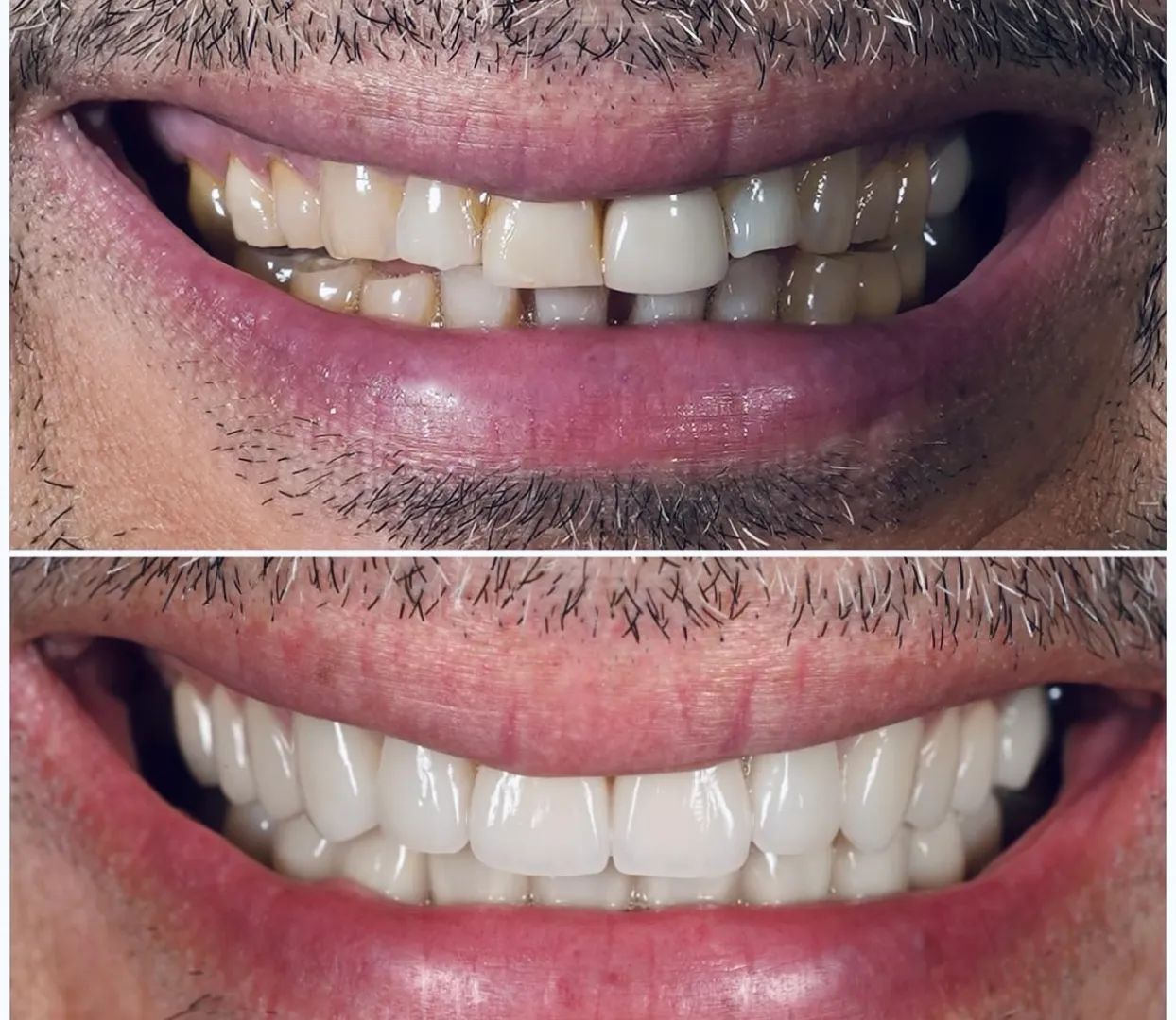 Smile Designing image 1