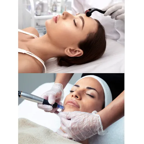 Microneedling image 1