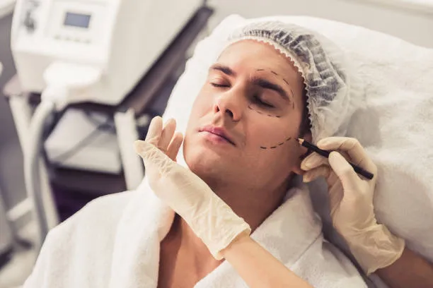 Cheek Contouring image 1