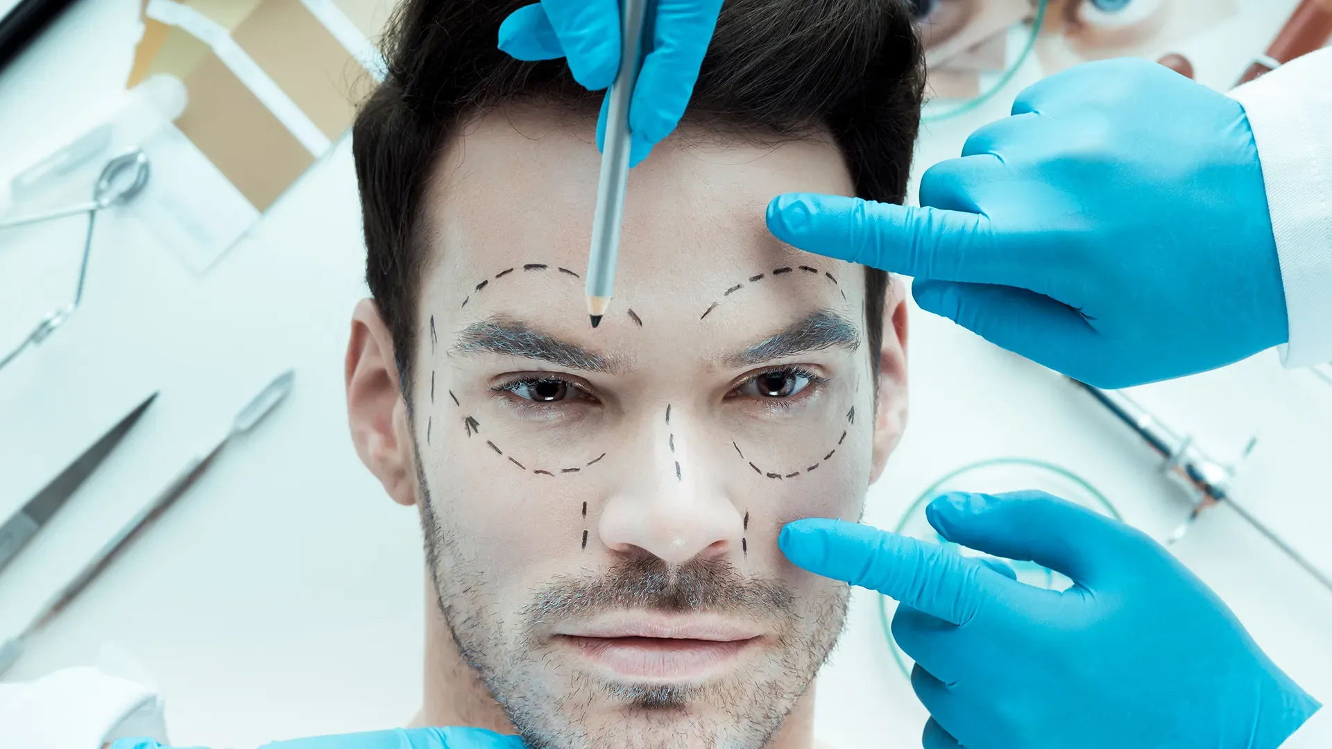 Face Lift image 1