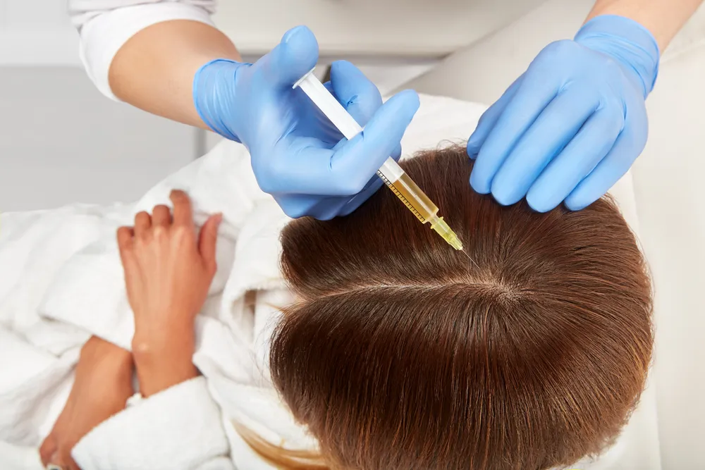 PRP (Platelet Rich Plasma) image 1