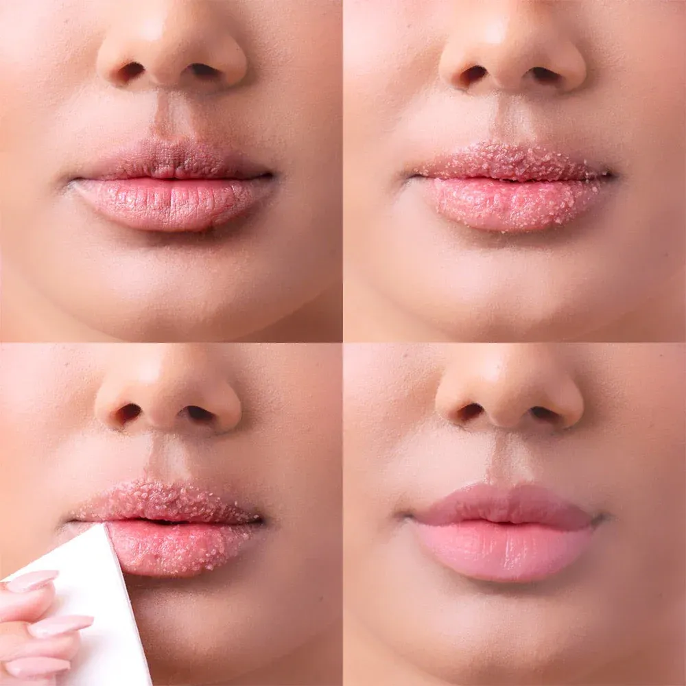 Lip Peel image 1