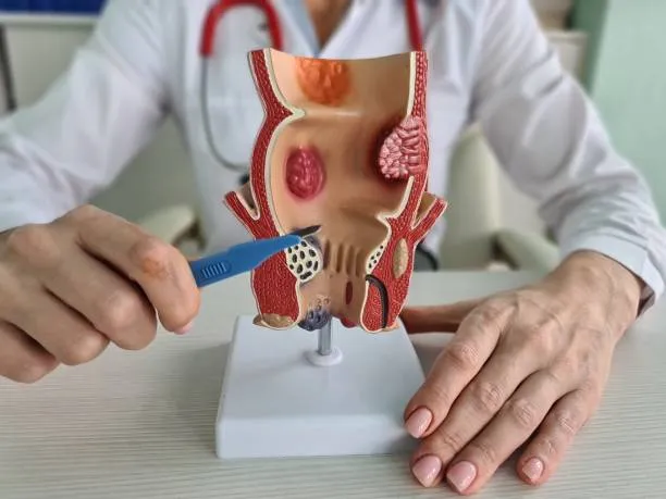 Colorectal Surgery image 1