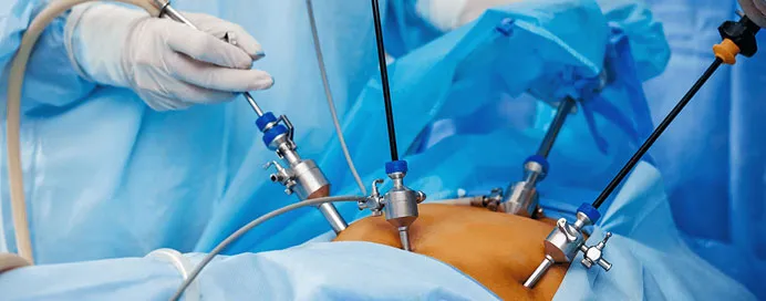 Laparoscopic Surgery image 2
