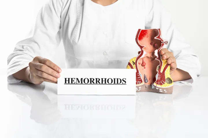 Hemorrhoid Surgery image 1