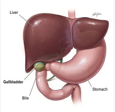 Gall Bladder Surgery image 1