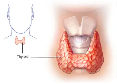Thyroid Disorders Treatment in Pune image 1